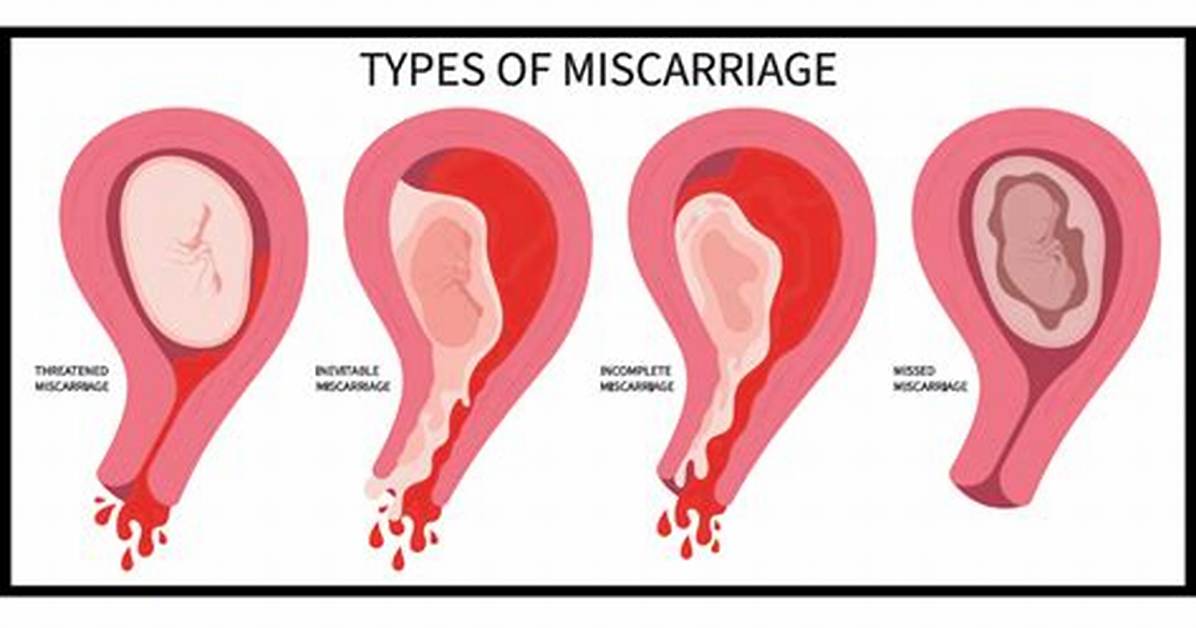 Can Lady Bloom Cause Miscarriage? the Dangerous Truth Behind Herbal Pregnancy Rumors