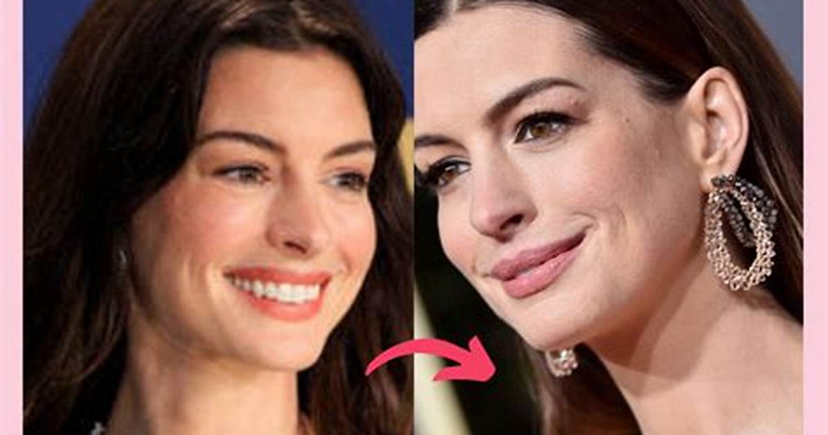 Did Anne Hathaway Get Botox? the Star Breaks Her Silence on 'Distracting' Cosmetic Rumors