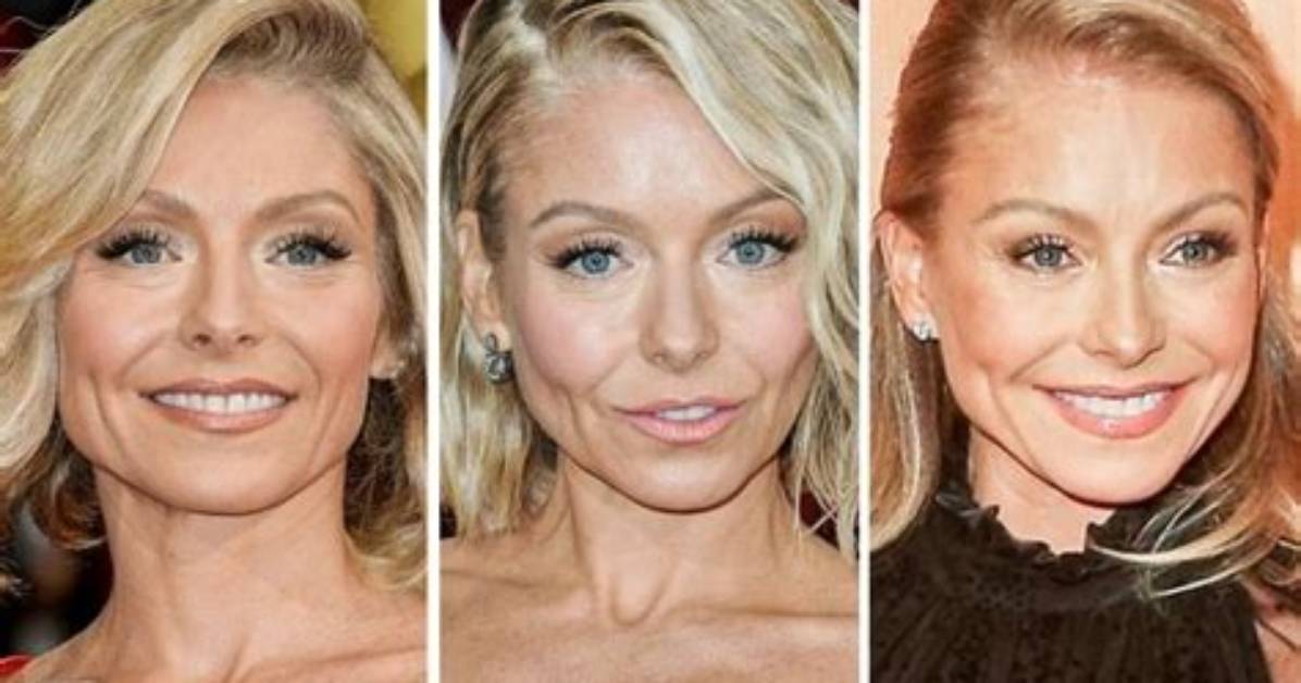 Kelly Ripa Before and After: the Photos Reigniting Plastic Surgery Speculation