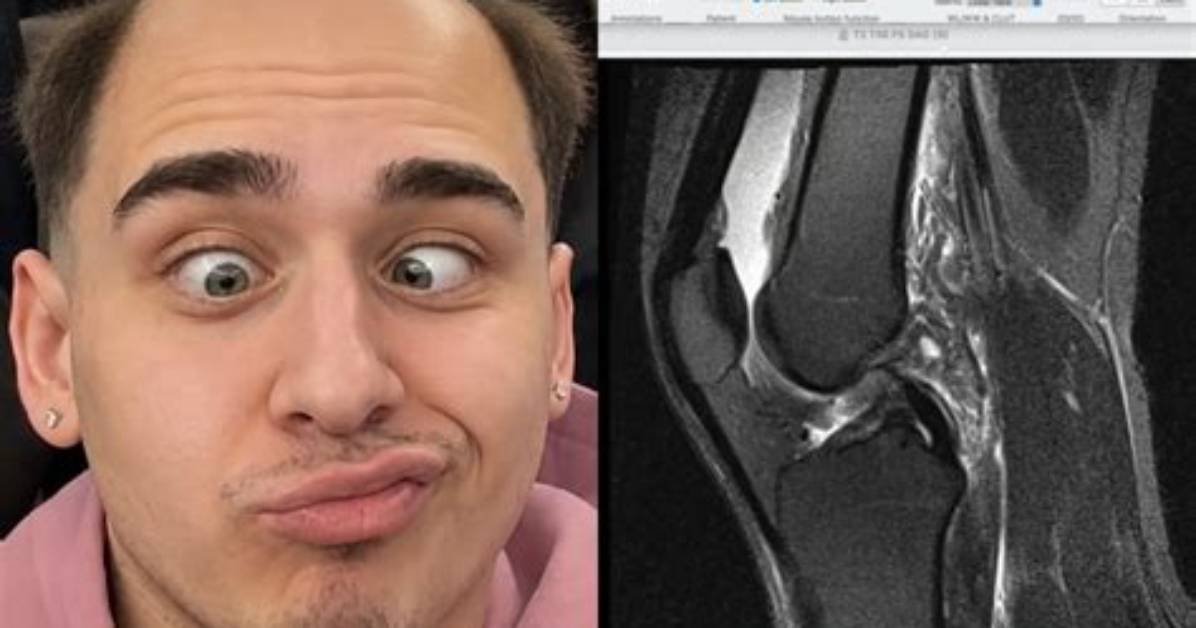 Lacy Knee Surgery Explained: Diagnosis, Stream Hiatus, and Expected Recovery Timeline