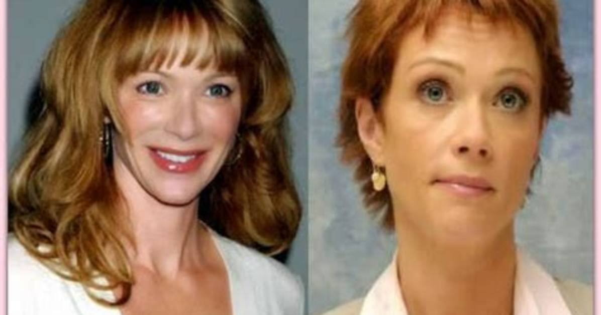 Lauren Holly Plastic Surgery Faq: Answers to Fans' Most Searched Questions