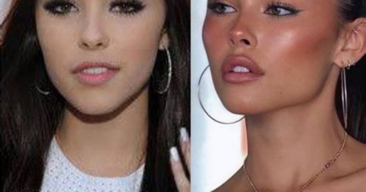 Madison Beer Bare-Faced: Side-by-Side Proof of Her Signature Glam Vs. Natural Skin