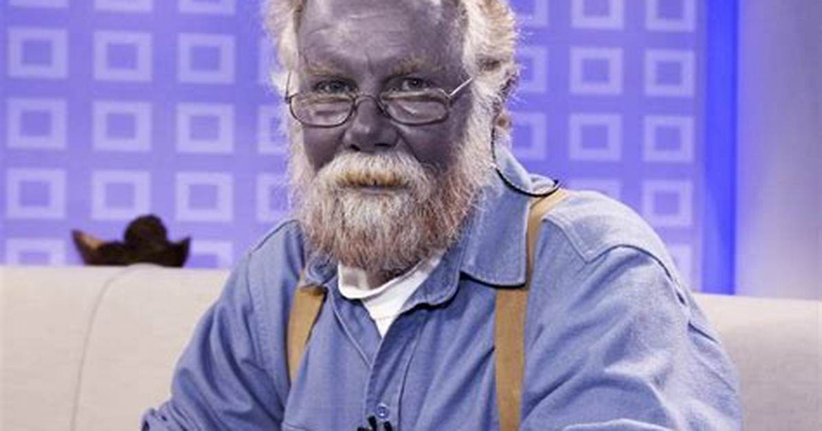 Real Humans Who Turned Blue: the Shocking True Medical Cases Behind the Line