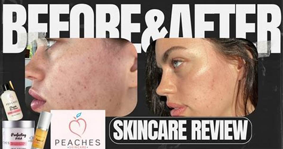 Silky Peach Cream Real Before and After: 30-Day Testing Results Exposed