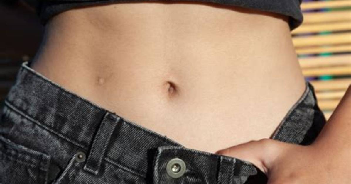 What to Do If Your Belly Button Ring Is Rejecting: Complete Recovery Guide
